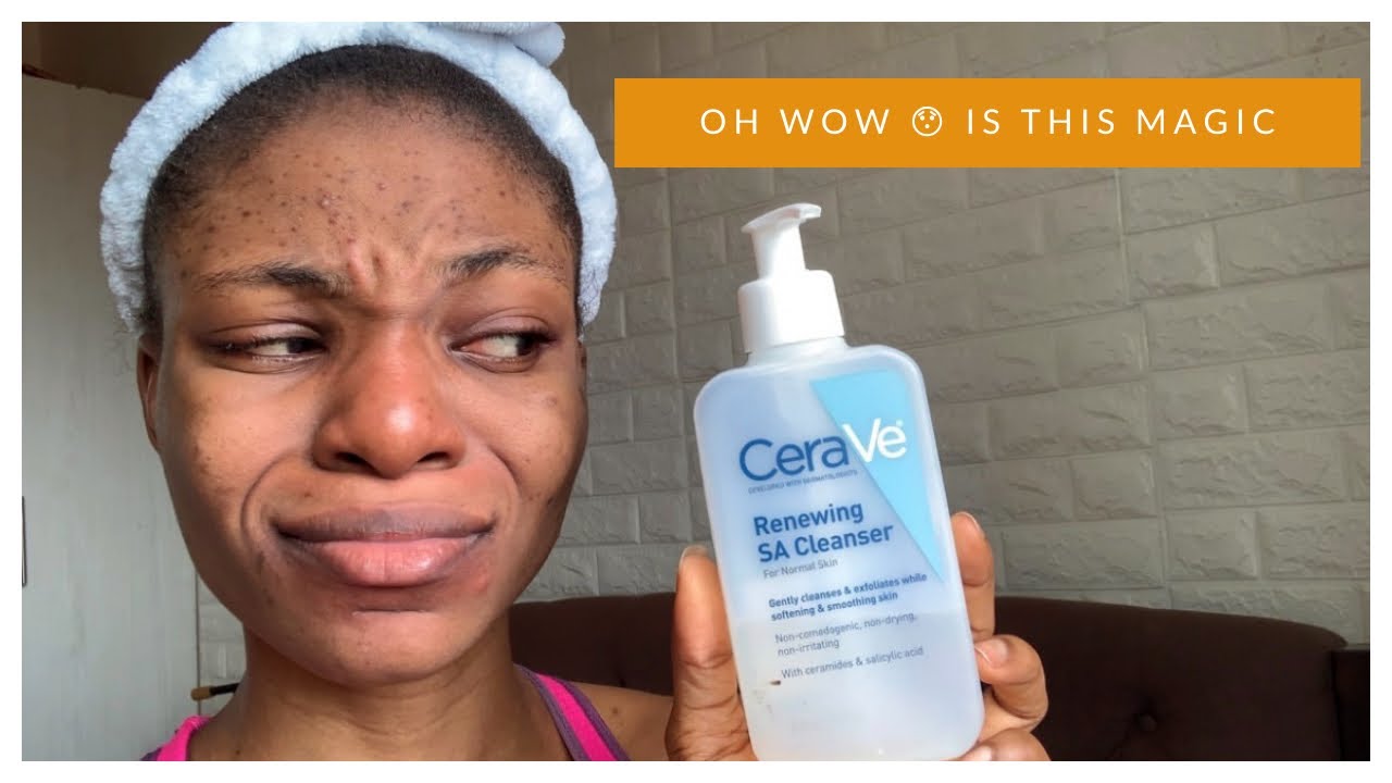 I Used Cerave Renewing SA Cleanser for 7 Days /Cerave Review on Acne