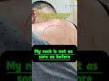 Mr. Chen undergoes his third treatment for cervical spondylolisthesis