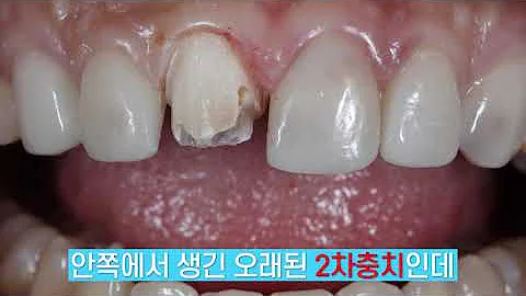 제로네이트 제로네이트