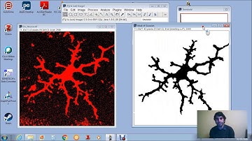 Gaussian Filter y Skeletonize