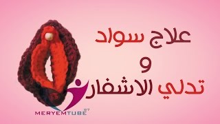 طريقة تبييض وشد الاشفار