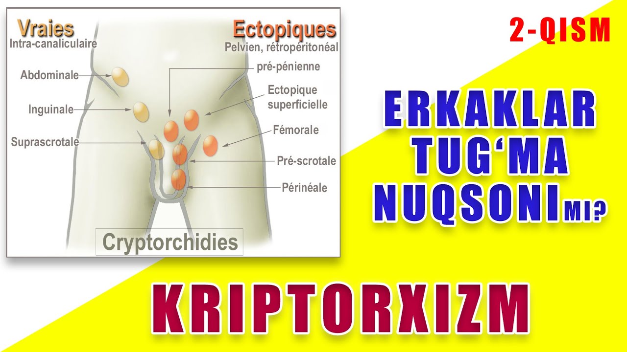 Jinsiy aloqa va kriptorxizm