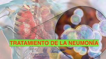 ¿Qué antibióticos curan la neumonía?
