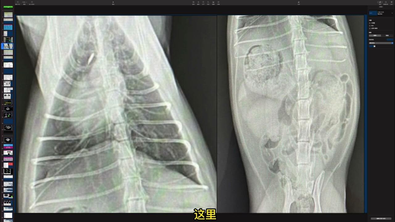 5112 ICTERUS CAT , ECHOCARDIOGRAPHY, MYOCARDIAL WORK INDEX , ABDOMINAL