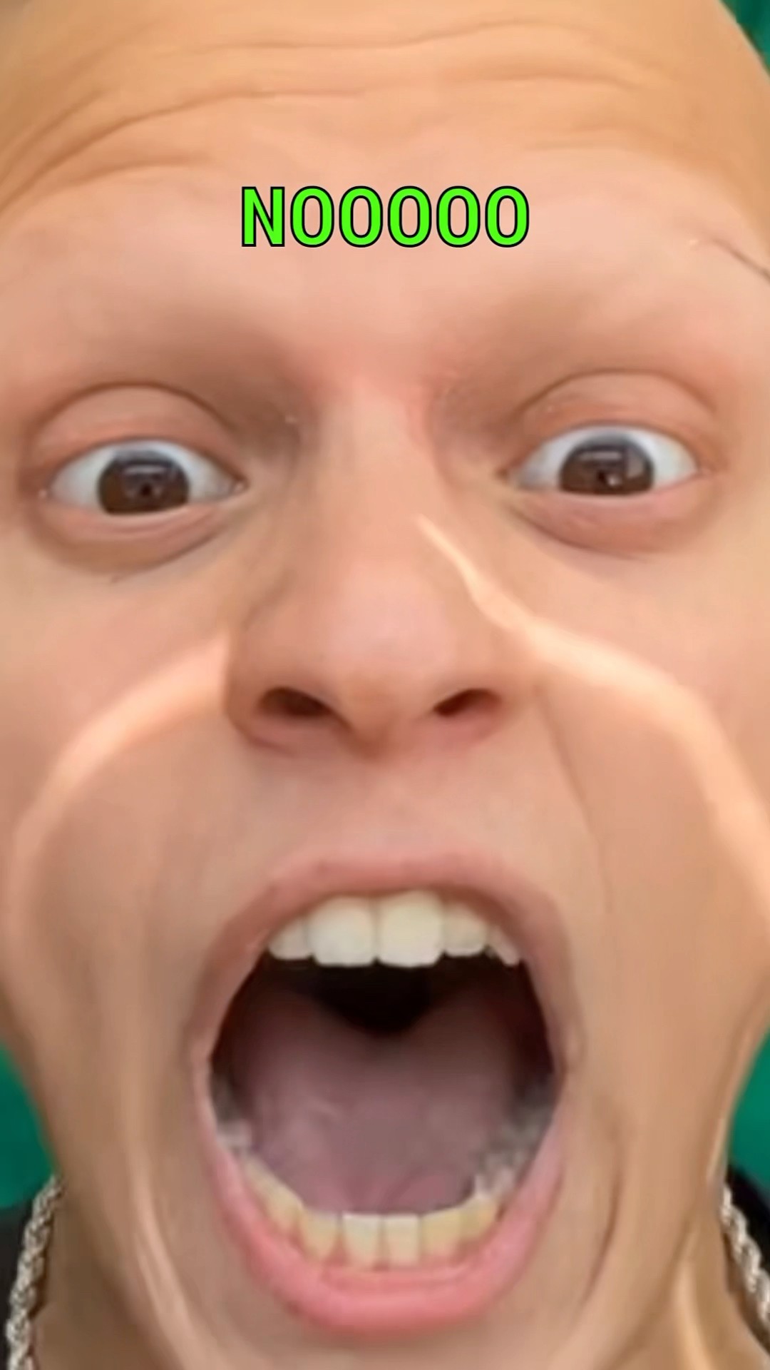 I have ALOPECIA TRUST ISSUES! ???‍? #comedy #funny #lol #alopecia