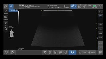 Venue Family Tutorials: Optimizing B-Mode
