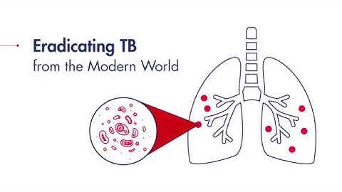 Eradicating TB from the modern world