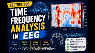 Lecture#09 - Time-Frequency Analysis in EEG