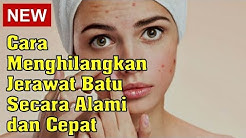 Cara Menghilangkan Jerawat Batu Secara Alami dan Cepat - Durasi: 5.29. 