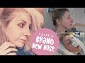 NOSE JOB VLOG - From Surgery to Recovery (Rhinoplasty / Septorhinoplasty Journey)