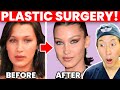Fox Eye Lift, Lip Fillers, Nose Job, and More? Bella Hadid Plastic Surgery Analysis!