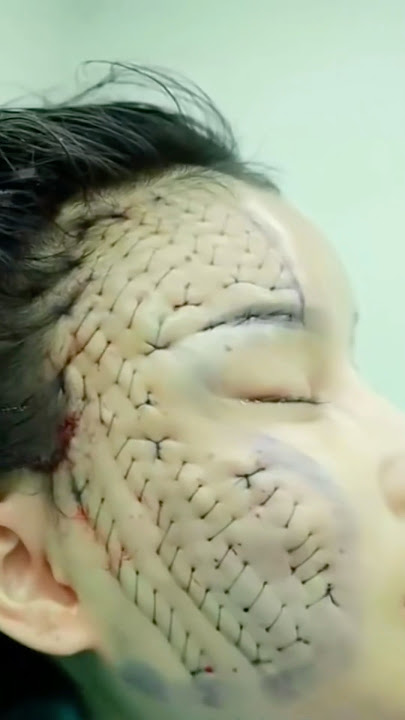 Did you know that plastic surgery in South Korea is so extreme…