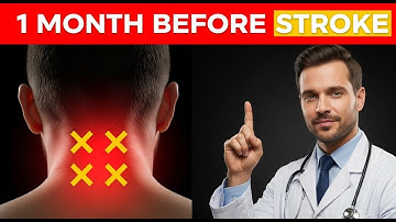 3 Early Warning Signs of a Stroke - Recognize Stroke Symptoms FAST: THIS Could Save Your Life