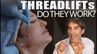 The REAL TRUTH About THREADLIFTS   No Lies Only ANSWERS