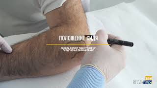 Канюльная техника периартикулярных инъекций
