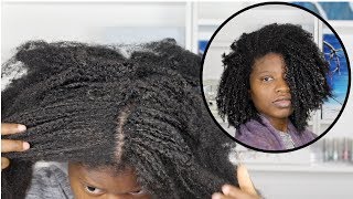 GETTING RID OF DANDRUFF AND FLAKES FOR TYPE 4 NATURAL HAIR ft. As I Am Dry & Itchy Scalp Care