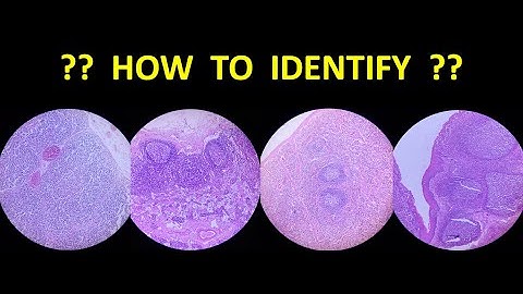 Identification of General Histology Slides