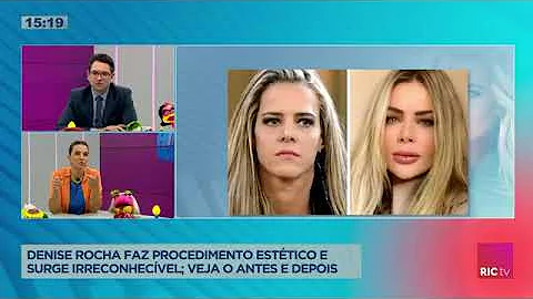 Denise Rocha faz procedimento esttico e surge irre...