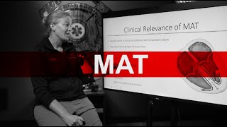 Multifocal Atrial Tachycardia