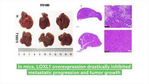 LOXL1 suppresses colorectal tumor growth in mice
