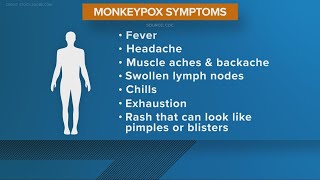 Monkeypox emergency declared by US, cases tick upward in Ohio as local COVID-19 cases decline
