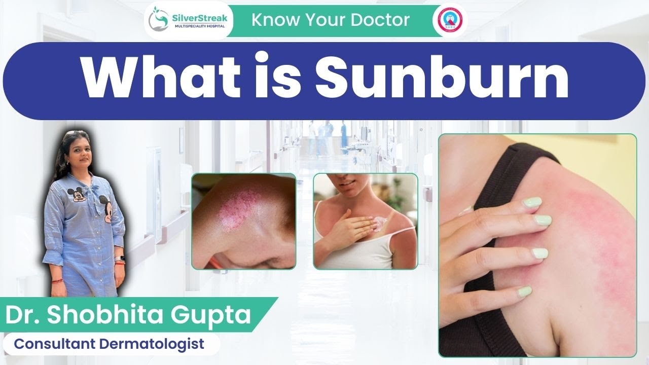 What is Sunburn || Dr. Shobhita Gupta, Consultant Dermatologist. adlı videoyu YouTube'da izle What is Sunburn || Dr. Shobhita Gupta, Consultant Dermatologist. adlı videoyu YouTube'da izle