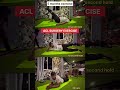 ACL SURGERY RECOVERY EXERCISE #aclrecovery #viralvideo #shortsfeed #viral