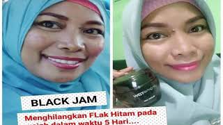 cara menghilangkan bekas jerawat black jam original raw