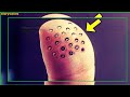 These Weird Spots Suddenly Appeared on His Finger. When the Doctors Saw It, They Called the Police!