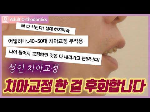   치아교정 후회 성인치아교정 어디까지 진실이고 거짓일까 40 60대 치아교정