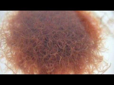 download tubifex worms in humans download tubifex worms in humans