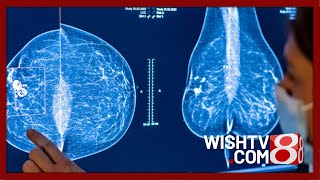 Multicultural Spotlight Addressing Breast Cancer Screening Challenges Among Latina Women