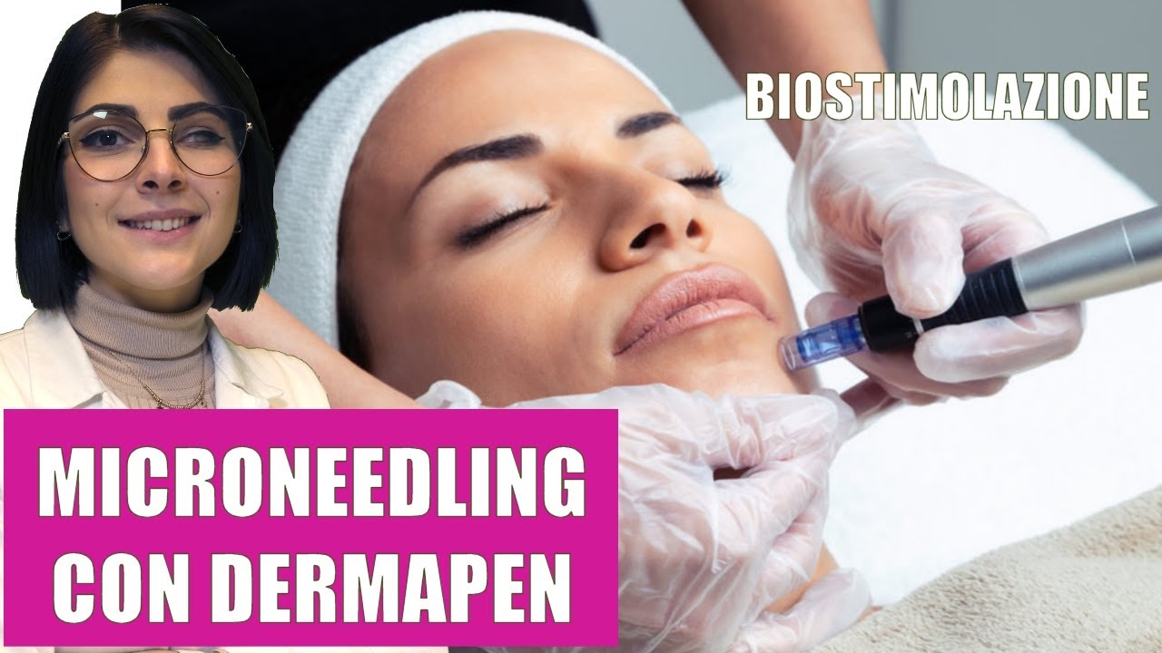 MICRONEEDLING CON DERMAPEN: BIOSTIMOLAZIONE DELLA PELLE
