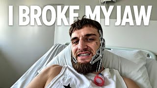 LIAM CAMERON: MY JAW SURGERY JOURNEY – BEFORE, DURING & AFTER OPERATION | HOSPITAL EXPERIENCE