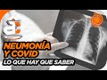 Neumonía bilateral: la causa más común de complicación de un cuadro de covid