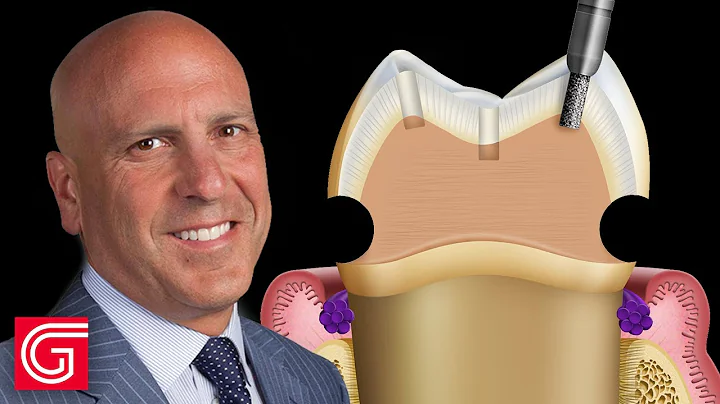 Molar Crown Preparation Using Reverse Preparation ...