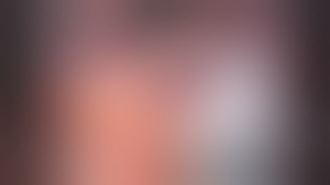 Laparoscopic Videos (edited-12)- Lap Chole in Previous Abdominal Surgery 2