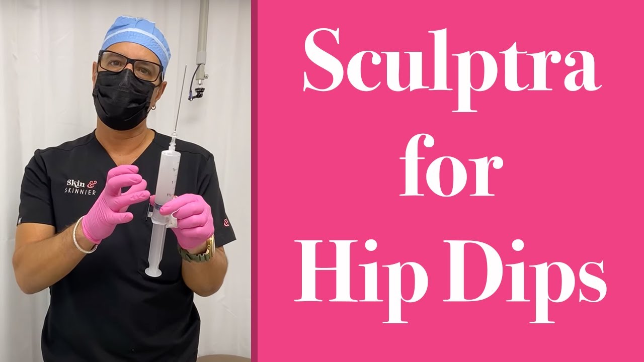 Sculptra for Hip Dips - Skinny BBL San Diego 🍑 