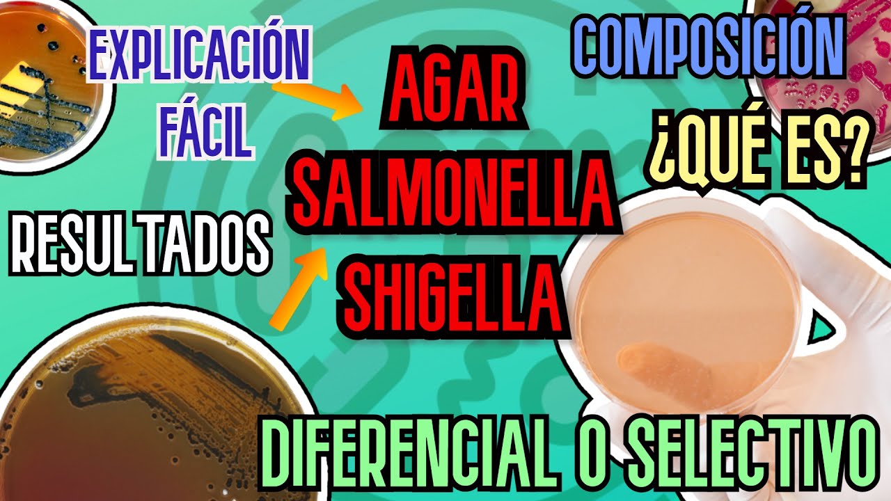 Medio de cultivo salmonella shigella. AGAR SS. Agar salmonella shigella españolAGAR SS microbiología
