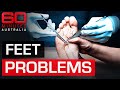 Lives ruined after their foot surgery went horribly wrong | 60 Minutes Australia