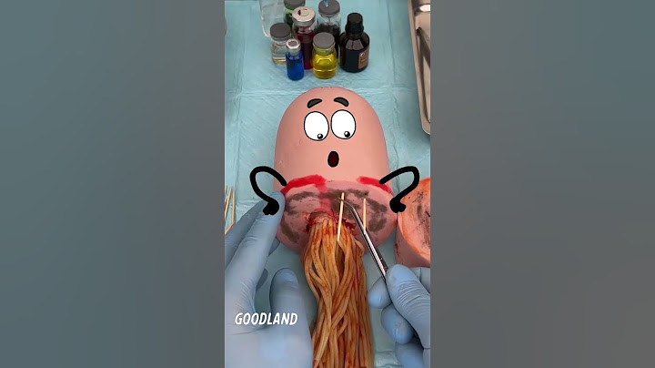 Goodland | Operation on sausage with intestines 😂 #goodland #Fruitsurgery #doodles #foodsurgery