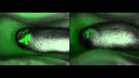Cranial neural crest cells expressing GFP