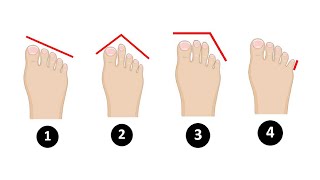 أصابع قدميك تكشف عن سمات شخصيتك