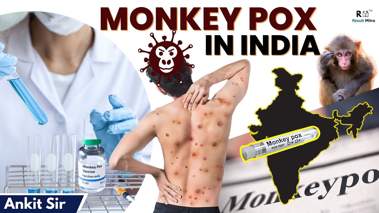 Monkeypox | First Case in India (भारत में दी मंकीपॉक्स ने दस्तक ) | # ...