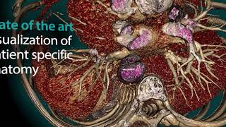 Famous Vesalius3D in 1min - 3D Medical Imaging Made Easy Profile