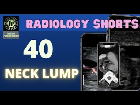 RADIOLOGYSHORTS | CASE40 | Neck Lump | NoBAKBAK