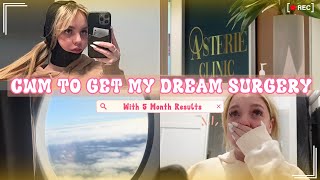 Come Get My Dream Surgery?!? LIFE CHANGING?? || 5 Month Update & Results