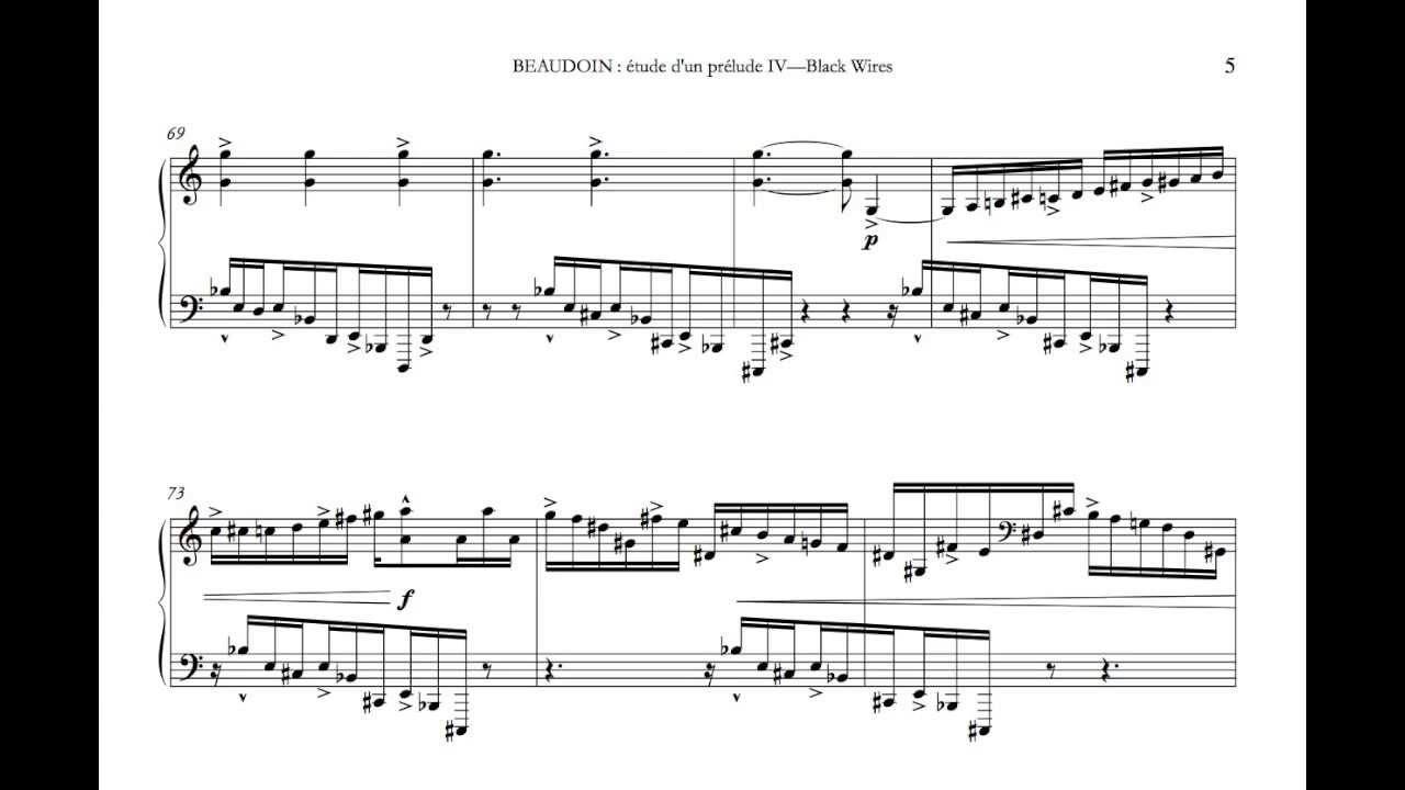 BEAUDOIN - Black Wires (Knoop)