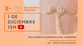 Encuentros Digitales: Tratamiento quirúrgico del linfedema