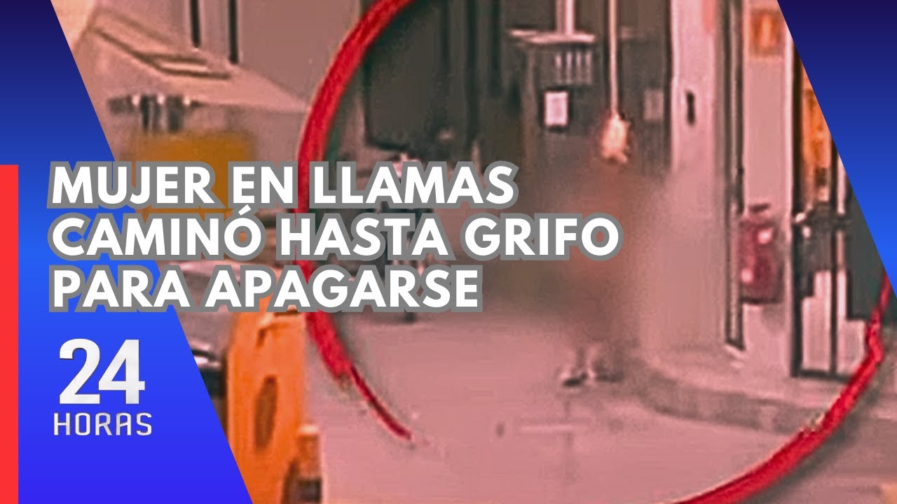 Mujer con 50% del cuerpo quemado lucha por su vida en Hospital Arzobispo Loayza